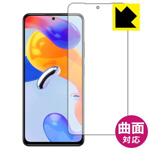 Flexible Shieldy  zیtB Xiaomi Redmi Note 11 Pro 5G / Redmi Note 11 Pro (Oʂ̂) { А