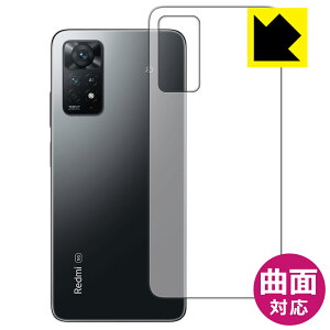 Flexible Shieldy  zیtB Xiaomi Redmi Note 11 Pro 5G / Redmi Note 11 Pro (wʂ̂) { А