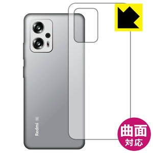 Flexible Shieldy  zیtB Xiaomi Redmi Note 11T Pro (wʂ̂) { А