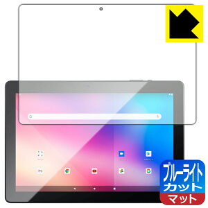 �u���[���C�g�J�b�g�y ���˒ጸ �z�ی�t�B���� JENESIS JT10-X1 ���{�� ���А�������