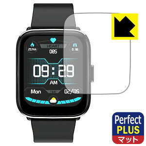 Perfect Shield Plusy ˒ጸ zیtB G12 Pro X}[gEHb` { А