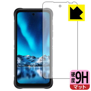 PDA�H�[ UMIDIGI BISON 2 PRO�Ή� 9H���d�x[���˒ጸ] �ی� �t�B���� ���{�� ���А�������