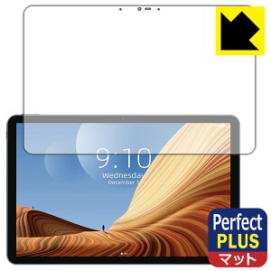 Perfect Shield Plus�y ���˒ጸ �z�ی�t�B���� CHUWI HiPad Air ���{�� ���А�������