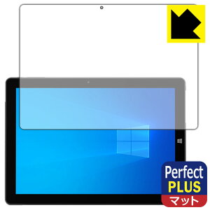 PDA�H�[ ALLDOCUBE iWork 20 Pro�Ή� PerfectShield Plus �ی� �t�B���� ���˒ጸ �h�w�� ���{�� ���А�������
