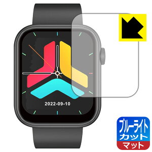 PDAH[ X}[gEHb` QX7 / FIPRIN 7082Ή u[CgJbg[˒ጸ] ی tB { А