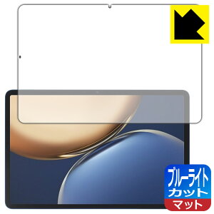 PDA�H�[ Honor Pad V7 Pro�Ή� �u���[���C�g�J�b�g[���˒ጸ] �ی� �t�B���� ���{�� ���А�������