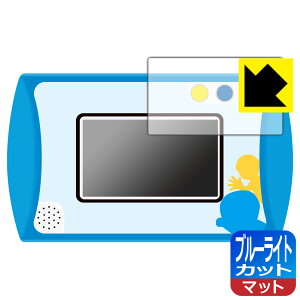 PDA�H�[ �J������!�v���O���~���O��! �h��������GIGA�p�b�h�Ή� �u���[���C�g�J�b�g[���˒ጸ] �ی� �t�B���� ���{�� ���А�������