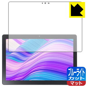 PDA�H�[ LUCA Tablet 10�C���` TM102M4N2-B / TM102M4N1-B�Ή� �u���[���C�g�J�b�g[���˒ጸ] �ی� �t�B���� ���{�� ���А�������