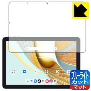 PDAH[ UMIDIGI G3 TabΉ u[CgJbg[˒ጸ] ی tB { А