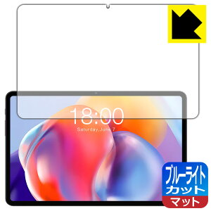 PDA�H�[ Teclast T40S�Ή� �u���[���C�g�J�b�g[���˒ጸ] �ی� �t�B���� ���{�� ���А�������