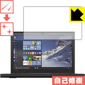 �L�Y���ȏC���ی�t�B���� ThinkPad X260 ���{�� ���А�������