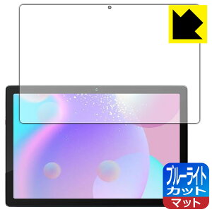 PDA�H�[ HiGrace MB1001 �Ή� �u���[���C�g�J�b�g[���˒ጸ] �ی� �t�B���� ���{�� ���{�� ���А�������