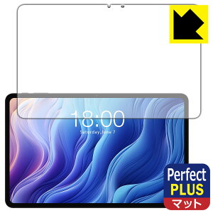 PDA�H�[ Teclast T60 �Ή� PerfectShield Plus �ی� �t�B���� ���˒ጸ �h�w�� ���{�� ���{�� ���А�������