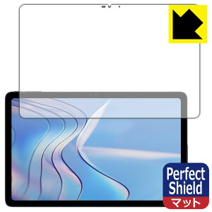 PDA�H�[ DOOGEE T20S �Ή� PerfectShield �ی� �t�B���� [��ʗp] ���˒ጸ �h�w�� ���{�� ���{�� ���А�������