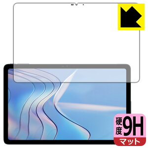 PDA�H�[ DOOGEE T20S �Ή� 9H���d�x[���˒ጸ] �ی� �t�B���� [��ʗp] ���{�� ���{�� ���А�������