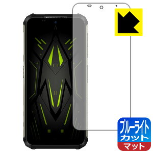 PDA�H�[ Ulefone Armor 22 �Ή� �u���[���C�g�J�b�g[���˒ጸ] �ی� �t�B���� ���{�� ���{�� ���А�������