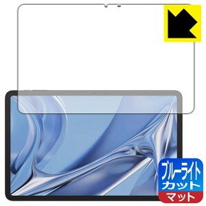 PDA�H�[ DOOGEE T20 Ultra �Ή� �u���[���C�g�J�b�g[���˒ጸ] �ی� �t�B���� ���{�� ���{�� ���А�������