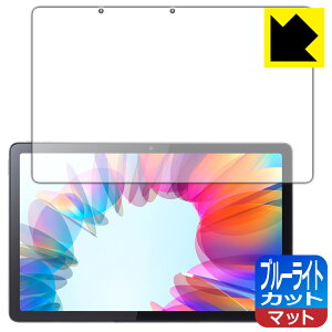 �u���[���C�g�J�b�g�y ���˒ጸ �z�ی�t�B���� Lenovo Tab M10a 5G ���{�� ���А�������