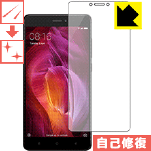 �L�Y���ȏC���ی�t�B���� Xiaomi Redmi Note 4 (Snapdragon��) ���{�� ���А�������