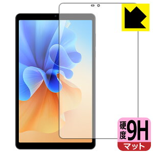 9H���d�x�y ���˒ጸ �z�ی�t�B���� AvidPad S30 ���{�� ���А�������