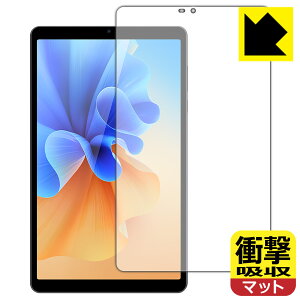 �Ռ��z���y ���˒ጸ �z�ی�t�B���� AvidPad S30 ���{�� ���А�������