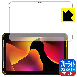 �u���[���C�g�J�b�g�y ���˒ጸ �z�ی�t�B���� Ulefone Armor Pad 2 ���{�� ���А�������