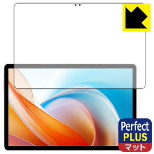 Perfect Shield Plusy ˒ጸ zیtB ALLDOCUBE iPlay 60 Lite (ʗp) { А