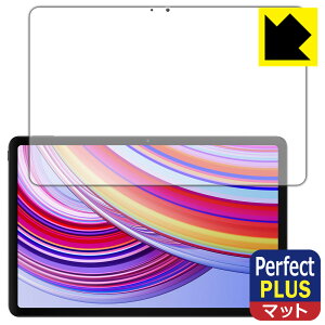 Perfect Shield Plus�y ���˒ጸ �z�ی�t�B���� Xiaomi Redmi Pad Pro (��ʗp) ���{�� ���А�������