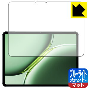PDA�H�[ OnePlus Pad Pro �Ή� �u���[���C�g�J�b�g[���˒ጸ] �ی� �t�B���� ���{�� ���А�������
