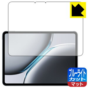 PDAH[ OnePlus Pad 2 Ή u[CgJbg[˒ጸ] ی tB { А