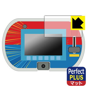 PDAH[ сE܂ȂтANeBu!g~JEv[pbh Ή PerfectShield Plus ی tB [ʕ̂] ˒ጸ hw { А