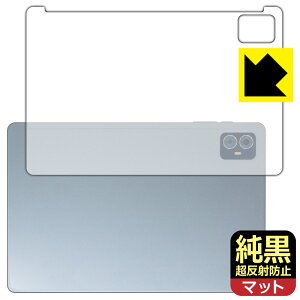 PDA�H�[ Teclast M50S �Ή� �����N���A[�����˖h�~] �ی� �t�B���� [�w�ʗp] ���˒ጸ �h�w�� ���{�� ���А�������