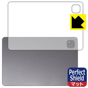 PDAH[ ALLDOCUBE iPlay 60 Pad Pro Ή PerfectShield ی tB [wʗp] ˒ጸ hw { А
