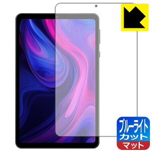 PDAH[ Alphawolf APad1 Ή u[CgJbg[˒ጸ] ی tB { А