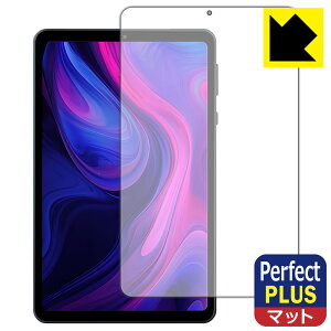 PDAH[ Alphawolf APad1 Ή PerfectShield Plus ی tB [ʗp] ˒ጸ hw { А