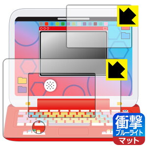 PDAH[ |PsJbƃAJf~[ |PQbgp\REX(GNXg[) Ή Ռz[u[CgJbg]˒ጸ ی tB [ʗp/ӂp] ϏՌ { А