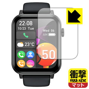 PDAH[ Nexmora X}[gEHb` F18 Ή Ռz[˒ጸ] ی tB ϏՌ { А