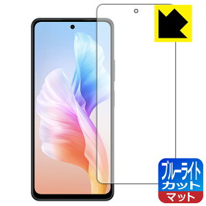 PDA�H�[ Blackview OSCAL TIGER 12 �Ή� �u���[���C�g�J�b�g[���˒ጸ] �ی� �t�B���� ���{�� ���А�������