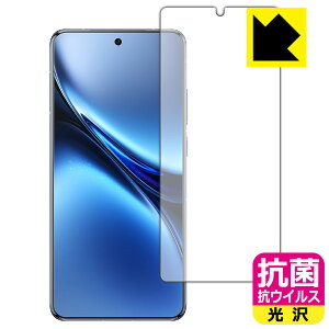 PDA�H�[ vivo X200 Pro �Ή� �R�� �R�E�C���X[����] �ی� �t�B���� [�w��F�ؑΉ�] ���{�� ���А�������