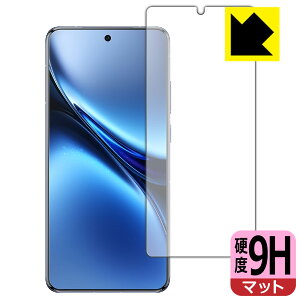 PDA�H�[ vivo X200 Pro �Ή� 9H���d�x[���˒ጸ] �ی� �t�B���� [�w��F�ؑΉ�] ���{�� ���А�������