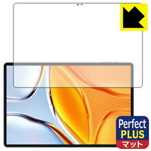 PDAH[ Teclast T70 Ή PerfectShield Plus ی tB [ʗp] ˒ጸ hw { А