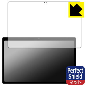 PDAH[ AvidPad S60 Ή PerfectShield ی tB [ʗp] 3 ˒ጸ hw { А