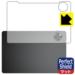 PDA�H�[ DOOGEE U11 �Ή� PerfectShield �ی� �t�B���� [�w�ʗp] ���˒ጸ �h�w�� ���{�� ���А�������