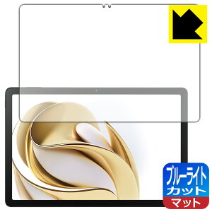 PDAH[ nubia Pad SE Ή u[CgJbg[˒ጸ] ی tB { А