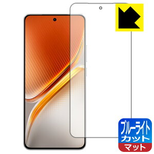 PDA�H�[ vivo iQOO Neo10 / iQOO Neo10 Pro �Ή� �u���[���C�g�J�b�g[���˒ጸ] �ی� �t�B���� [�w��F�ؑΉ�] ���{�� ���А�������