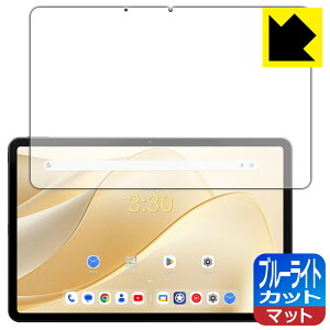 PDAH[ ALLDOCUBE iPlay 70 Pro Ή u[CgJbg[˒ጸ] ی tB { А