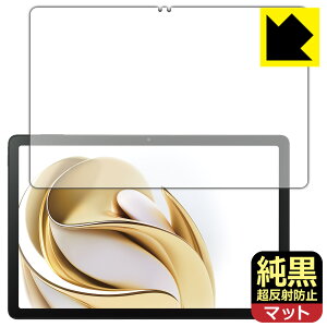 PDA�H�[ nubia Pad SE �Ή� �����N���A[�����˖h�~] �ی� �t�B���� [��ʗp] ���˒ጸ �h�w�� ���{�� ���А�������