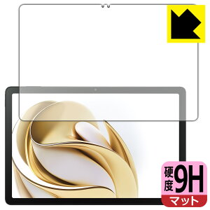PDA�H�[ nubia Pad SE �Ή� 9H���d�x[���˒ጸ] �ی� �t�B���� [��ʗp] ���{�� ���А�������