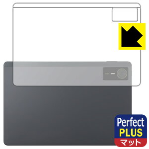 PDA�H�[ nubia Pad SE �Ή� PerfectShield Plus �ی� �t�B���� [�w�ʗp] ���˒ጸ �h�w�� ���{�� ���А�������