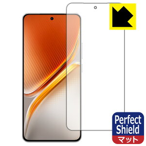 PDA�H�[ vivo iQOO Neo10 / iQOO Neo10 Pro �Ή� PerfectShield �ی� �t�B���� [�w��F�ؑΉ�] 3���� ���˒ጸ �h�w�� ���{�� ���А�������